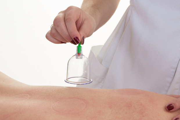 What is a cupping massage?